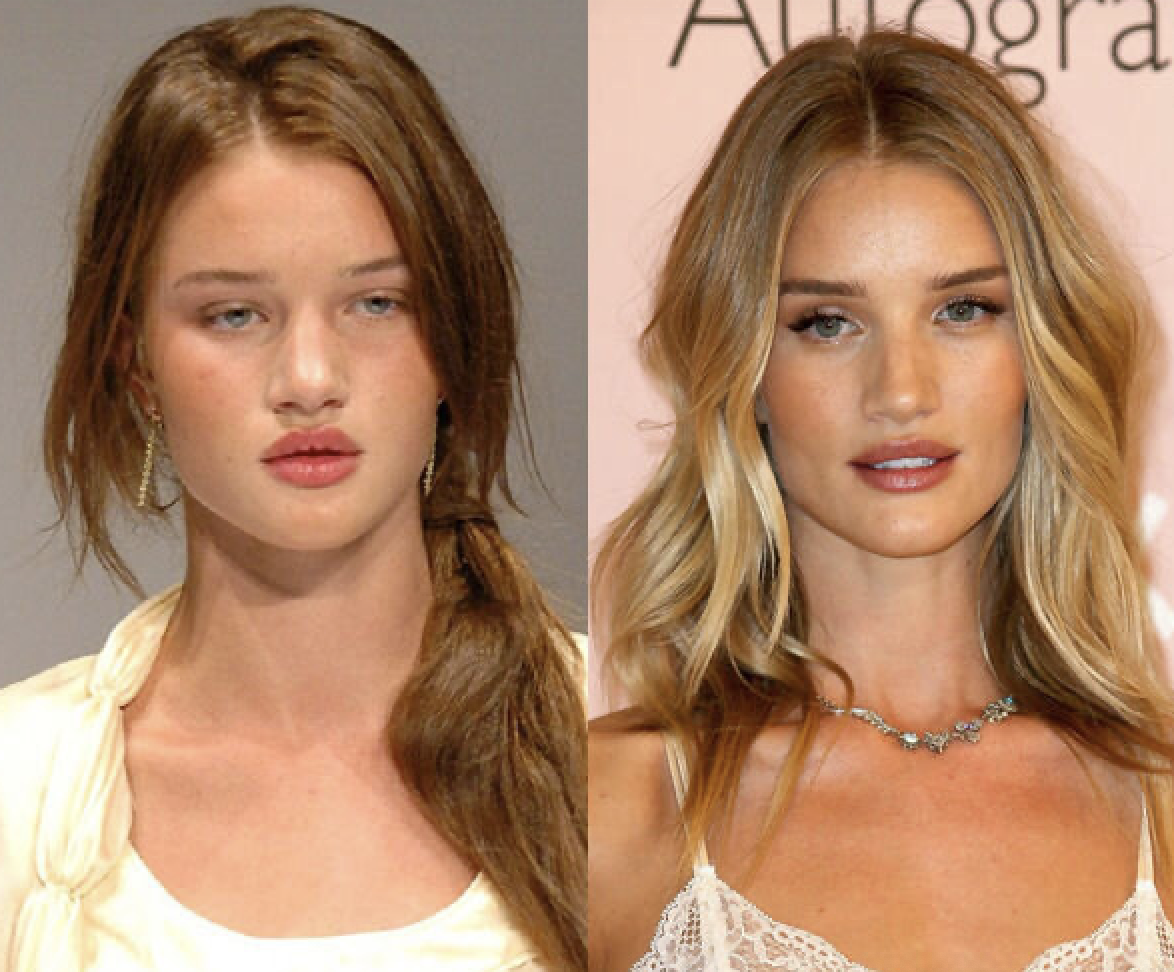 Звезды, у которых пухлые щечки превратились в красивые скулы