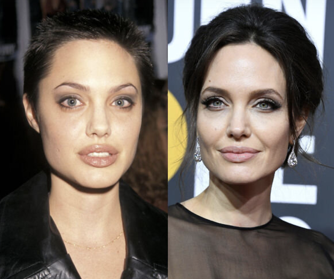 Звезды, у которых пухлые щечки превратились в красивые скулы