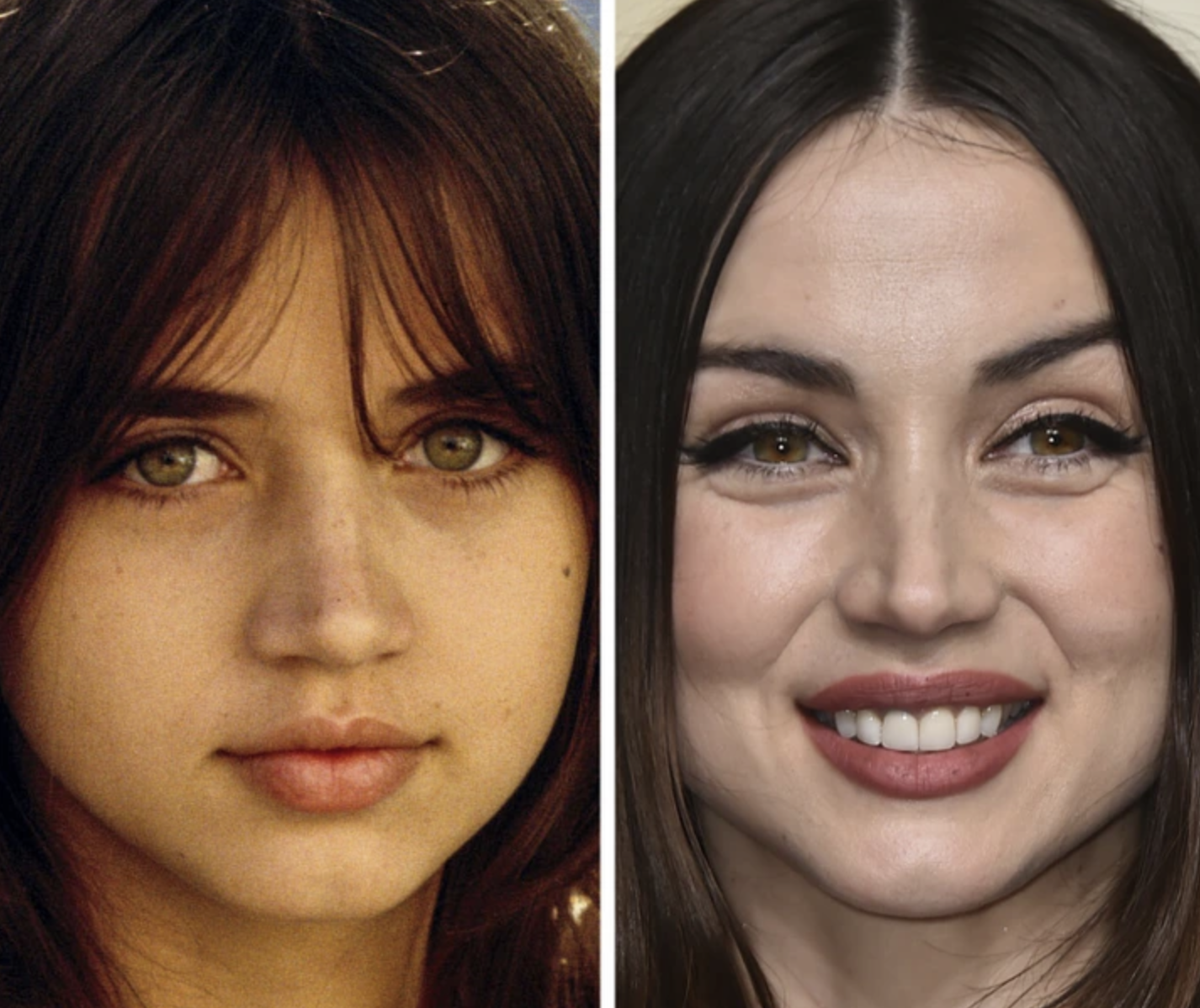 Звезды, у которых пухлые щечки превратились в красивые скулы