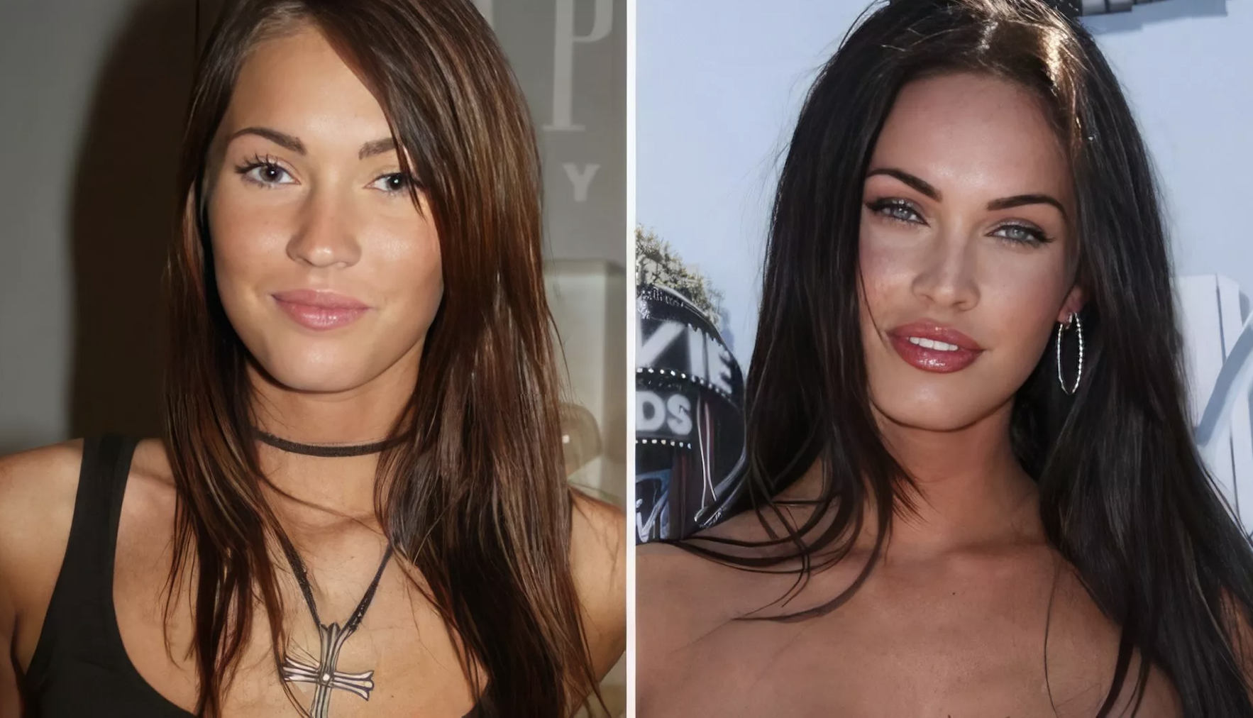 Звезды, у которых пухлые щечки превратились в красивые скулы