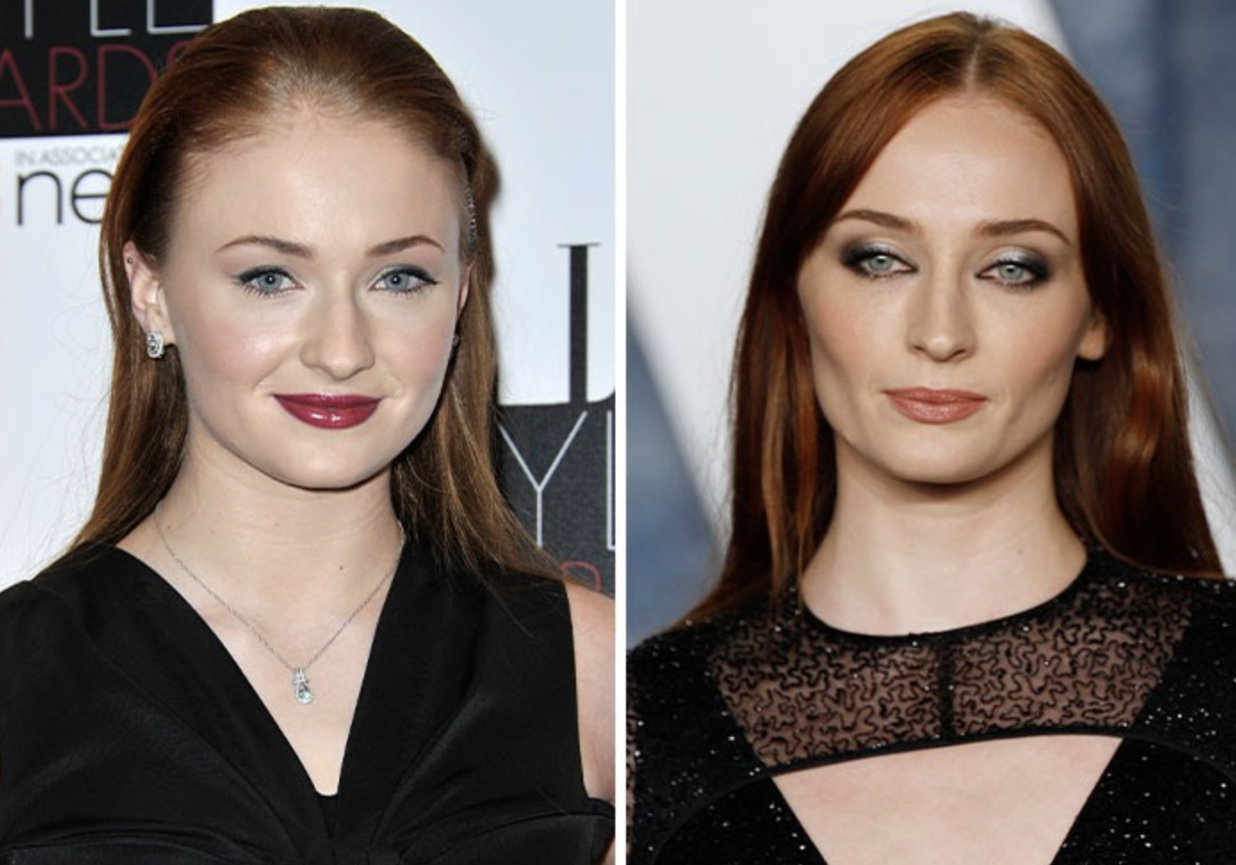 Звезды, у которых пухлые щечки превратились в красивые скулы