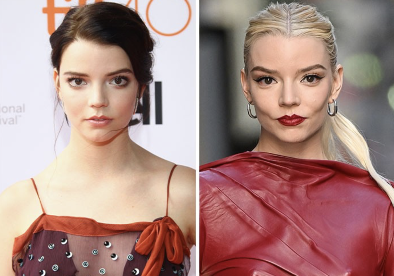 Звезды, у которых пухлые щечки превратились в красивые скулы