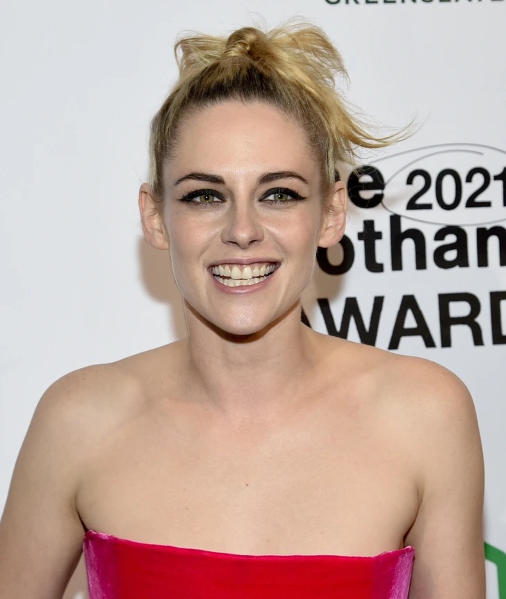 Знаменитости, которые не скрывают свои несовершенства