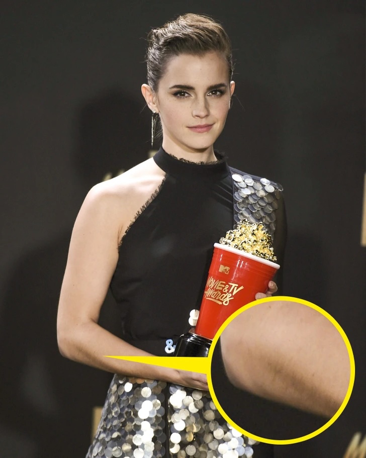 Знаменитости, которые не скрывают свои несовершенства