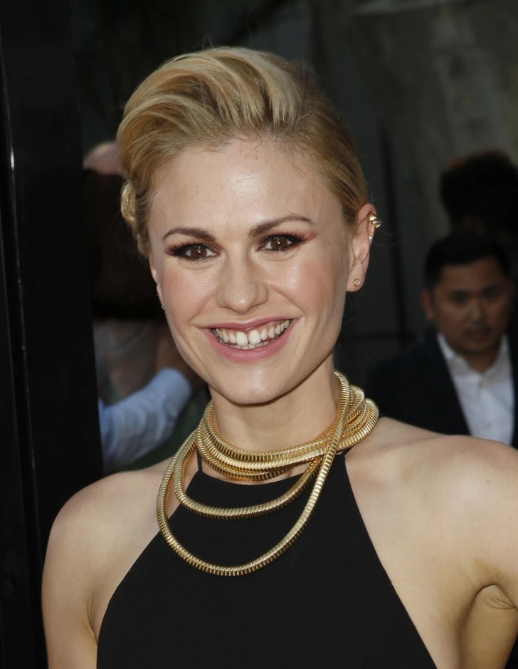 Знаменитости, которые не скрывают свои несовершенства