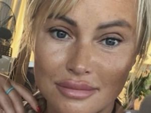 Дана Борисова шокировала Сеть фото после пластики лица