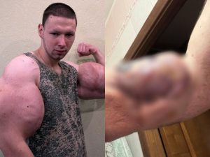 «Прости меня, Боженька»: фрик-блогер Руки-Базуки рассказал про сложную операцию
