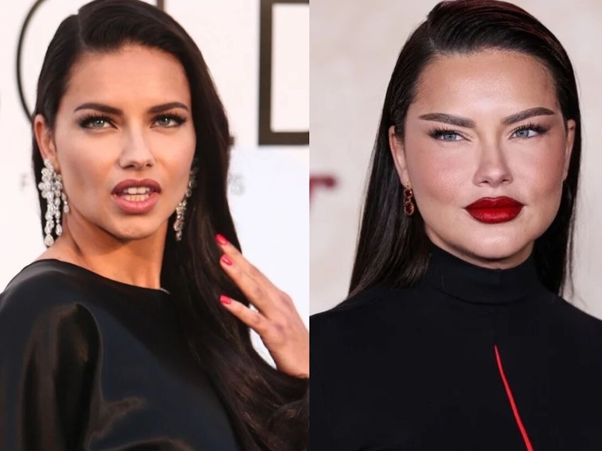 24 случая, когда бьюти-процедуры улучшили или испортили знаменитостей