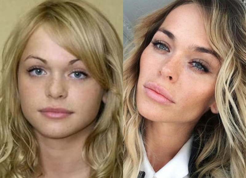 24 случая, когда бьюти-процедуры улучшили или испортили знаменитостей