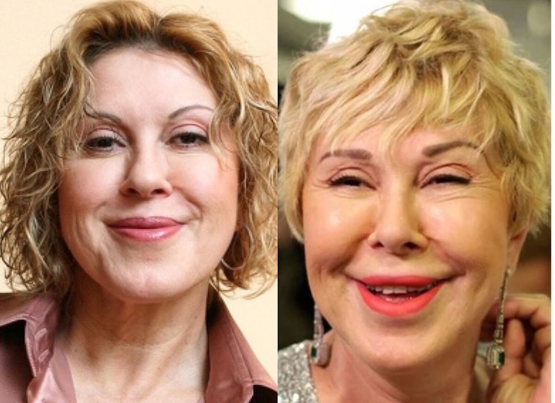 24 случая, когда бьюти-процедуры улучшили или испортили знаменитостей