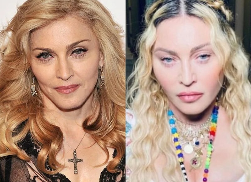 24 случая, когда бьюти-процедуры улучшили или испортили знаменитостей