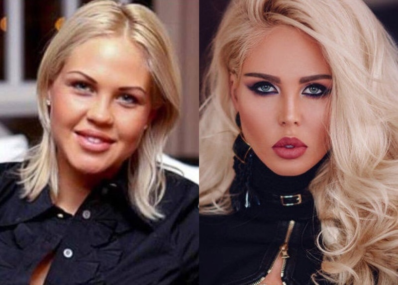 24 случая, когда бьюти-процедуры улучшили или испортили знаменитостей