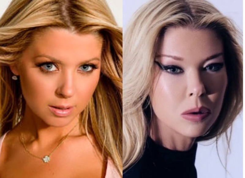 24 случая, когда бьюти-процедуры улучшили или испортили знаменитостей