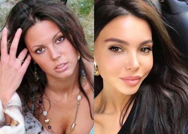 24 случая, когда бьюти-процедуры улучшили или испортили знаменитостей