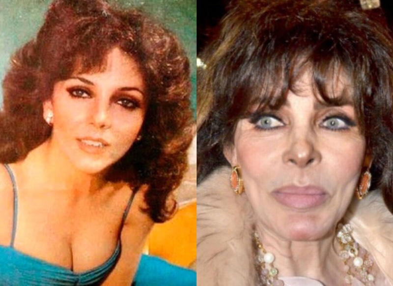 24 случая, когда бьюти-процедуры улучшили или испортили знаменитостей