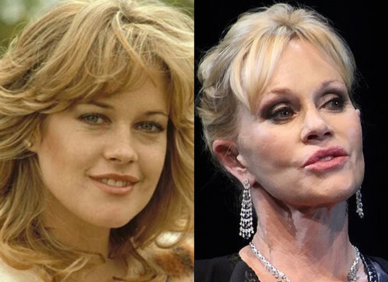 24 случая, когда бьюти-процедуры улучшили или испортили знаменитостей