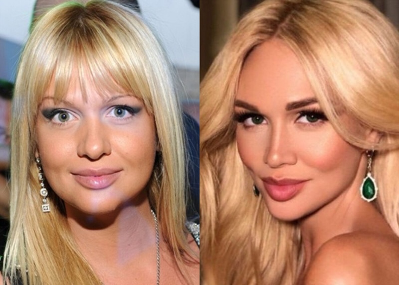 24 случая, когда бьюти-процедуры улучшили или испортили знаменитостей