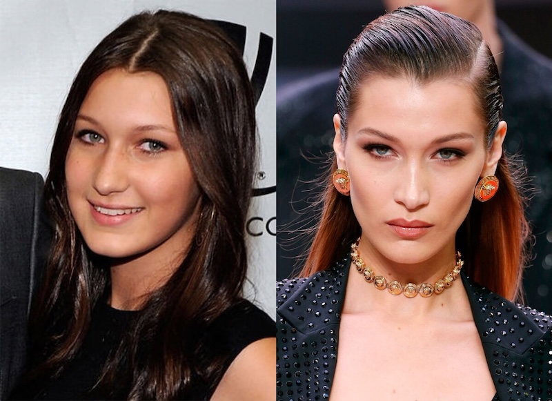 24 случая, когда бьюти-процедуры улучшили или испортили знаменитостей