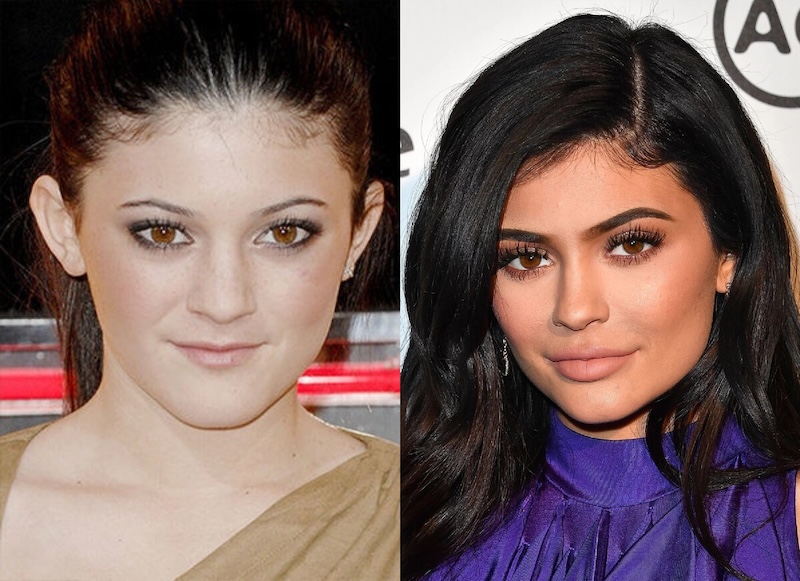 24 случая, когда бьюти-процедуры улучшили или испортили знаменитостей