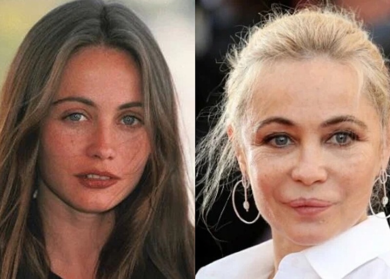 24 случая, когда бьюти-процедуры улучшили или испортили знаменитостей