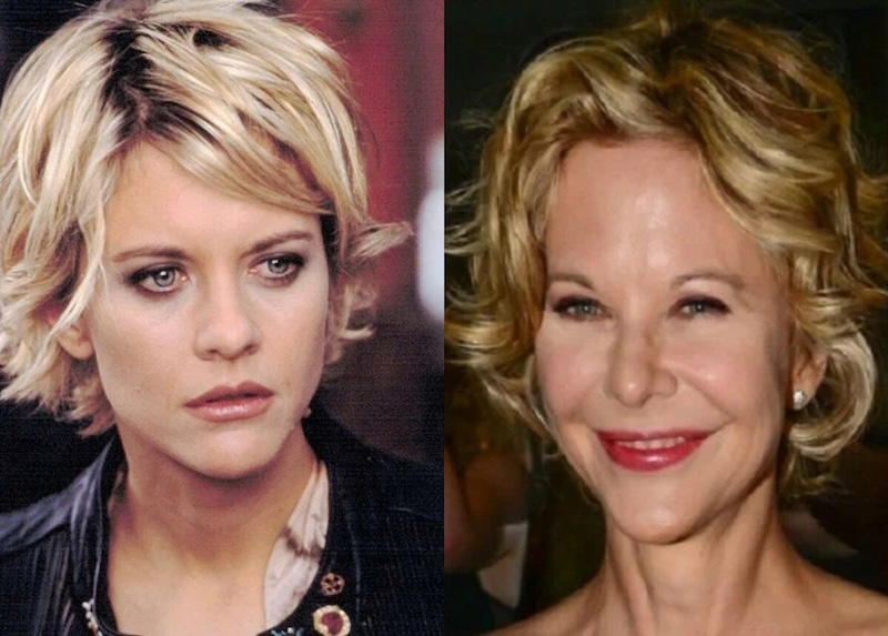 24 случая, когда бьюти-процедуры улучшили или испортили знаменитостей