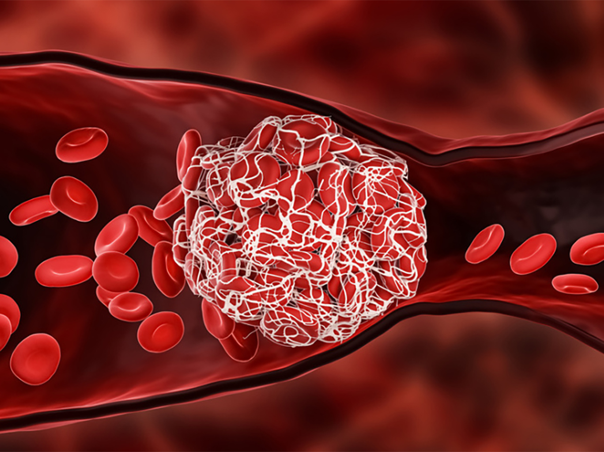 Холестерин