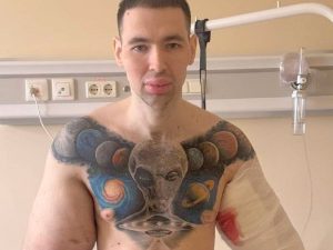 СМИ: блогеру Руки-Базуки грозит скорая ампутация конечностей