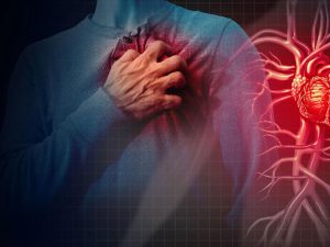 Бляшки в сосудах