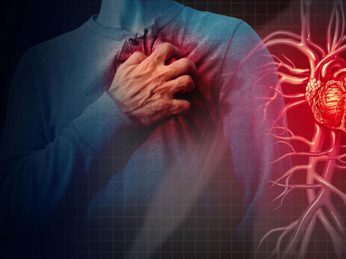 Бляшки в сосудах