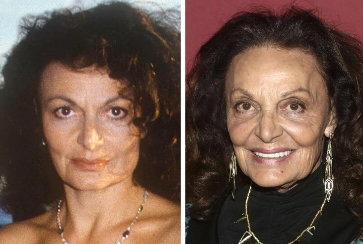 Звезды, которые стареют естественно и не боятся своего возраста