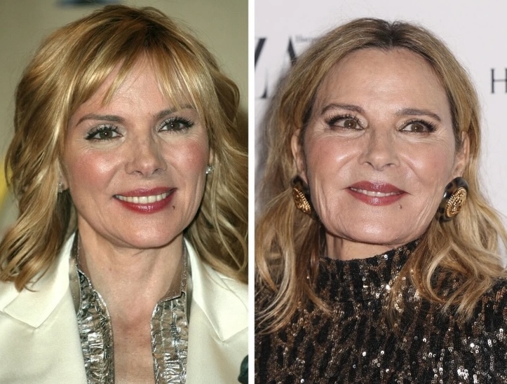 Звезды, которые стареют естественно и не боятся своего возраста