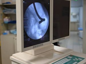 Уральский Минздрав поиздевался над пенсионеркой, которая чуть не погибла из-за сосиски