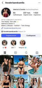 Сиамские близнецы Камила и Валерия