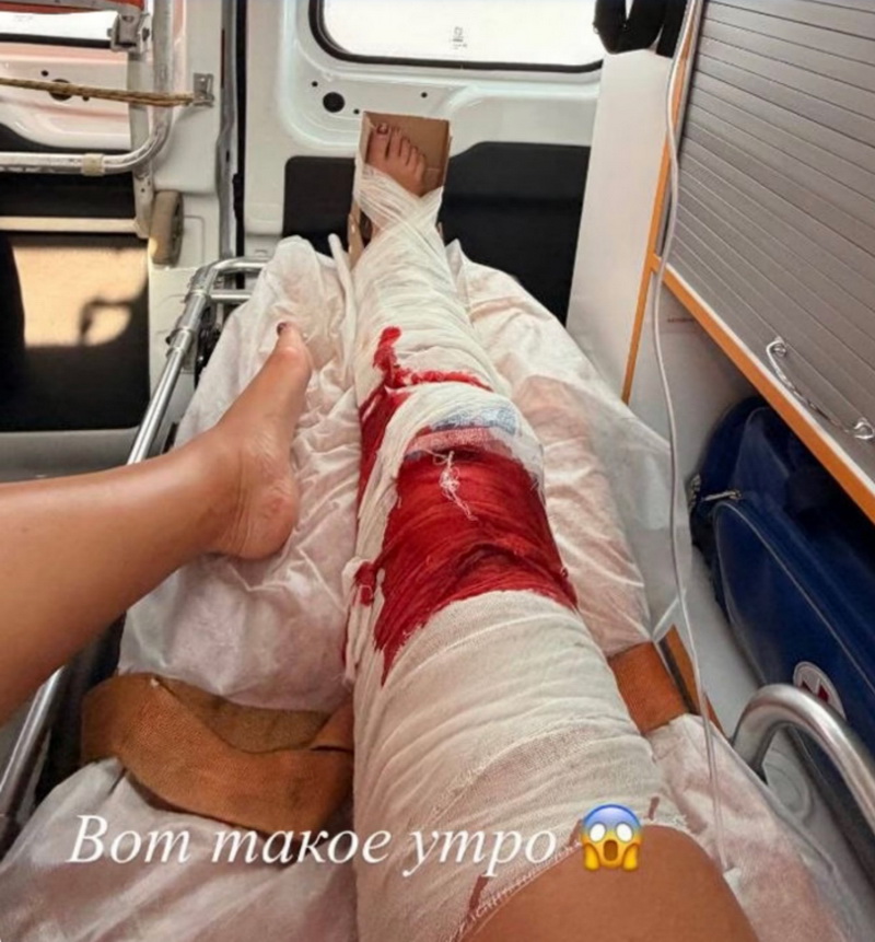 Бузова в скорой