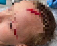 на семилетнего внука Дарьи Донцовой напал пес