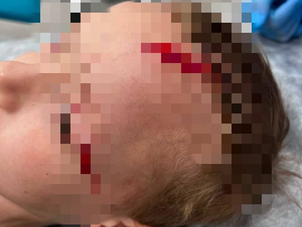 на семилетнего внука Дарьи Донцовой напал пес